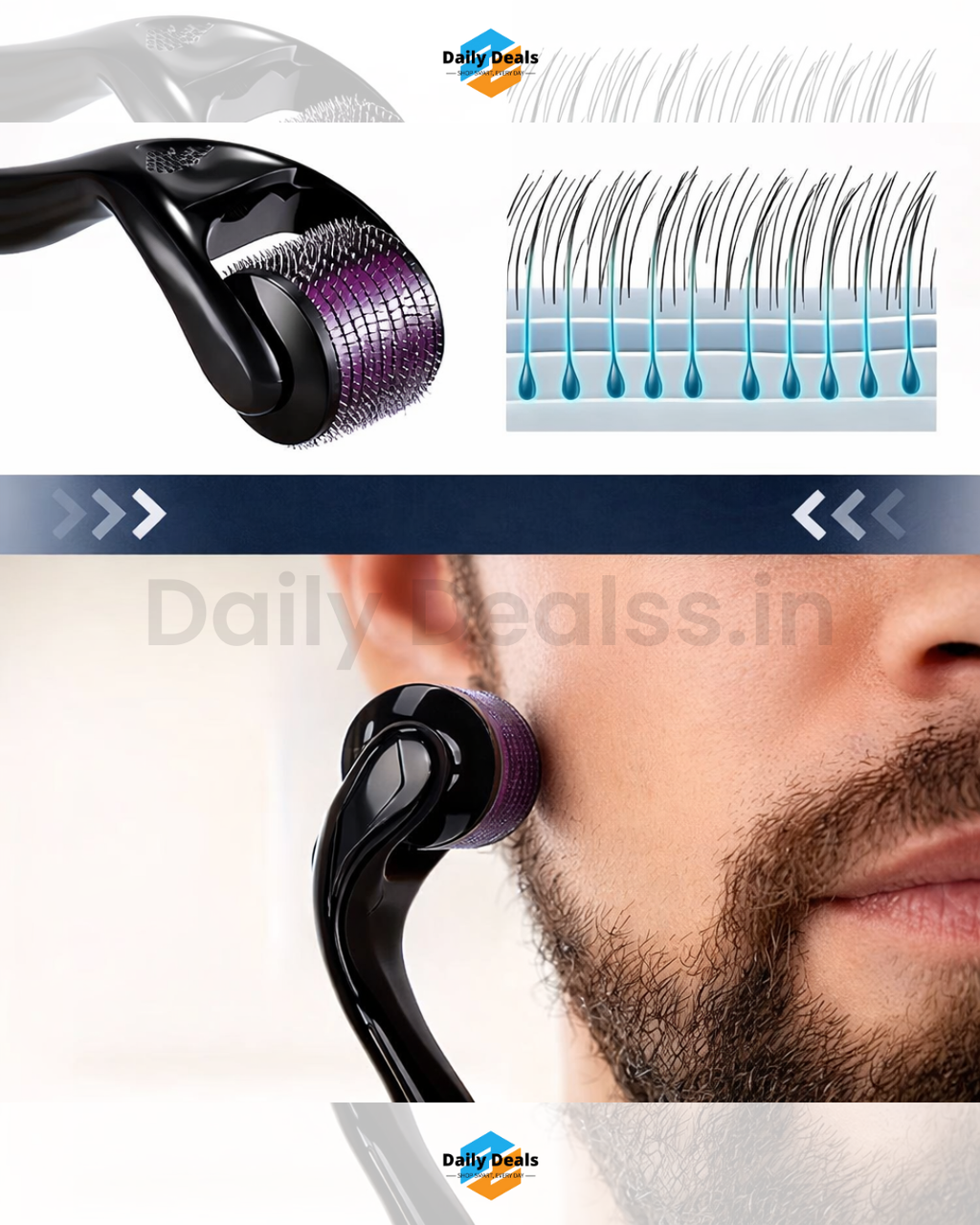 Derma Roller With 0.5 MM Titanium Microneedles  (Pack of 1 )