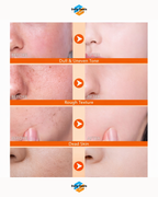 Exfoliating Kojic Acid Turmeric Spray 400ml (Pack of 2)