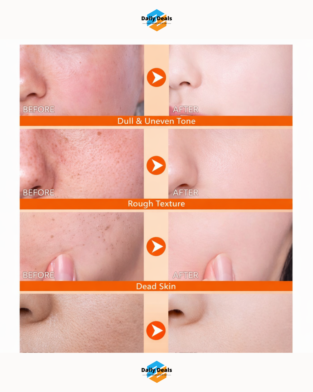 Exfoliating Kojic Acid Turmeric Spray 400ml (Pack of 2)