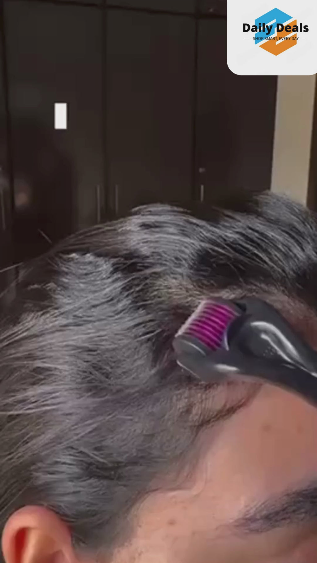 Derma Roller With 0.5 MM Titanium Microneedles  (Pack of 1 )